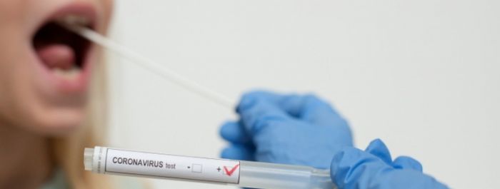 PCR mintavételi helyek tervezhető ellátások és beavatkozások előtt