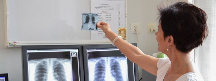 Változik a mátészalkai tüdőgyógyászati ellátás működése
